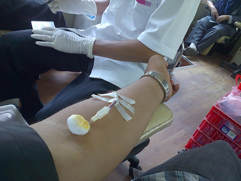 phlebotomy
